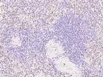 IL21R Antibody in Immunohistochemistry (Paraffin) (IHC (P))