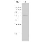 IL2RG Antibody in Western Blot (WB)