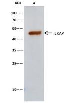 ILKAP Antibody in Immunoprecipitation (IP)