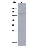 alpha Internexin Antibody in Immunoprecipitation (IP)