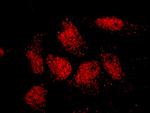 ISL2 Antibody in Immunocytochemistry (ICC/IF)