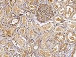 CD51 Antibody in Immunohistochemistry (Paraffin) (IHC (P))