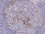 CD51 Antibody in Immunohistochemistry (Paraffin) (IHC (P))