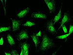 PHF17 Antibody in Immunocytochemistry (ICC/IF)