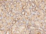 KEAP1 Antibody in Immunohistochemistry (Paraffin) (IHC (P))