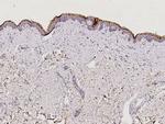 Kallikrein 7 Antibody in Immunohistochemistry (Paraffin) (IHC (P))