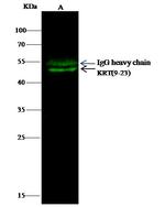 Cytokeratin Pan Type I/II Antibody in Immunoprecipitation (IP)