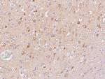 LC3A Antibody in Immunohistochemistry (Paraffin) (IHC (P))