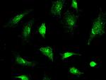 JNK2 Antibody in Immunocytochemistry (ICC/IF)