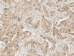 MMP13 Antibody in Immunohistochemistry (Paraffin) (IHC (P))