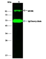 MUSK Antibody in Immunoprecipitation (IP)