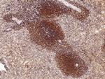 ARD1A Antibody in Immunohistochemistry (Paraffin) (IHC (P))