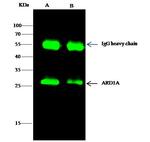 ARD1A Antibody in Immunoprecipitation (IP)