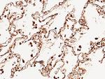 NBL1 Antibody in Immunohistochemistry (Paraffin) (IHC (P))