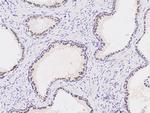 Nkx3.1 Antibody in Immunohistochemistry (Paraffin) (IHC (P))