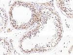 NR0B1 Antibody in Immunohistochemistry (Paraffin) (IHC (P))