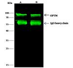 Optineurin Antibody in Immunoprecipitation (IP)