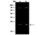 Oncostatin M Antibody in Western Blot (WB)