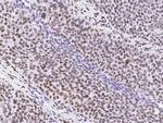 PAX8 Antibody in Immunohistochemistry (Paraffin) (IHC (P))