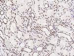 PAX8 Antibody in Immunohistochemistry (Paraffin) (IHC (P))