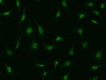 PIK3CB Antibody in Immunocytochemistry (ICC/IF)