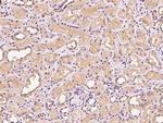 PIK3CB Antibody in Immunohistochemistry (Paraffin) (IHC (P))