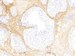 Periostin Antibody in Immunohistochemistry (Paraffin) (IHC (P))