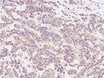 Prolactin Receptor Antibody in Immunohistochemistry (Paraffin) (IHC (P))