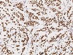 PSME3 Antibody in Immunohistochemistry (Paraffin) (IHC (P))