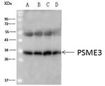 PSME3 Antibody in Immunoprecipitation (IP)