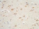 PTH1R Antibody in Immunohistochemistry (Paraffin) (IHC (P))