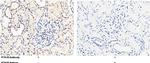 PTH1R Antibody in Immunohistochemistry (Paraffin) (IHC (P))