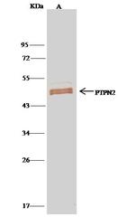 PTPN2 Antibody in Immunoprecipitation (IP)