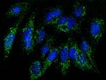 RAB27B Antibody in Immunocytochemistry (ICC/IF)