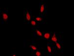 RAD18 Antibody in Immunocytochemistry (ICC/IF)