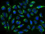 RBKS Antibody in Immunocytochemistry (ICC/IF)