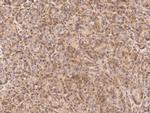 RIP3 Antibody in Immunohistochemistry (Paraffin) (IHC (P))