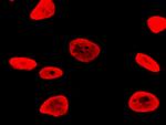 RSK3 Antibody in Immunocytochemistry (ICC/IF)