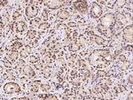 RSK3 Antibody in Immunohistochemistry (Paraffin) (IHC (P))