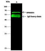 p70 S6 Kinase Antibody in Immunoprecipitation (IP)