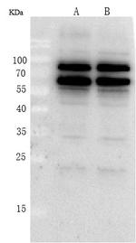 p70 S6 Kinase Antibody in Western Blot (WB)