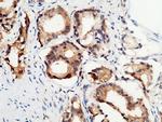 p53R2 Antibody in Immunohistochemistry (Paraffin) (IHC (P))