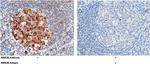 p53R2 Antibody in Immunohistochemistry (Paraffin) (IHC (P))