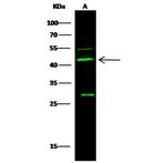 p53R2 Antibody in Western Blot (WB)