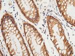 S100A16 Antibody in Immunohistochemistry (Paraffin) (IHC (P))