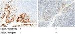 S100A7 Antibody in Immunohistochemistry (Paraffin) (IHC (P))