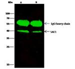 SAE1 Antibody in Immunoprecipitation (IP)