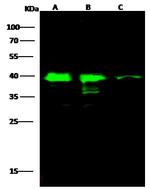 SAE1 Antibody in Western Blot (WB)