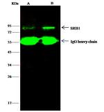 SR-BI Antibody in Immunoprecipitation (IP)