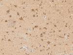 SCN2B Antibody in Immunohistochemistry (Paraffin) (IHC (P))